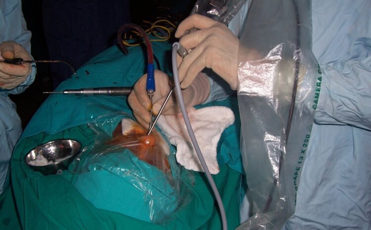  Endoskopik Sinüs Cerrahisi